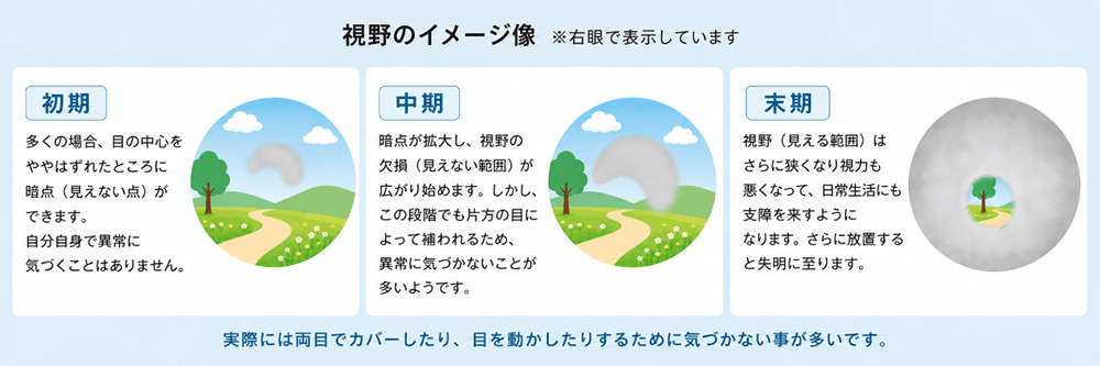 視野のイメージ像