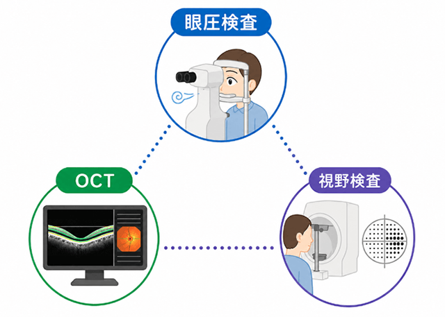 眼圧検査・OCT・視野検査