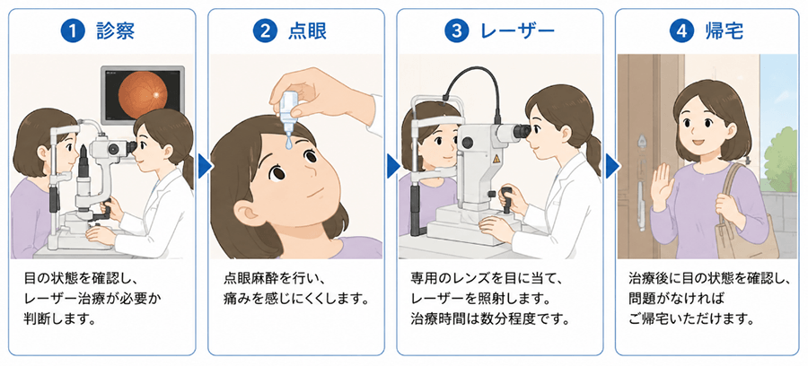 1.診察→2.点眼→3.レーザー→4.帰宅