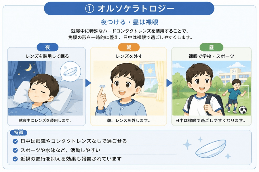 就寝中に特殊なハードコンタクトレンズを装用することで、角膜の形を一時的に整え、日中は裸眼で過ごしやすくします。