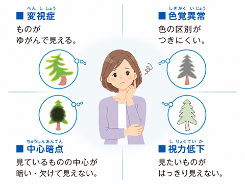 変視症（ものが歪んで見える）。色覚異常（色の区別がつきにくい）。中心暗転（見ているものの中心が暗い・欠けて見えない）。視力低下（見たいものがはっきり見えない）