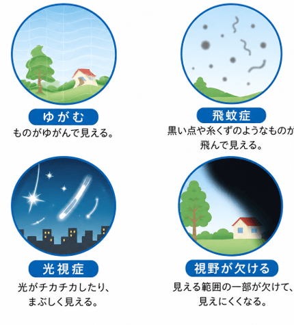 ゆがむ、飛蚊症、光視症、視野が欠ける。
