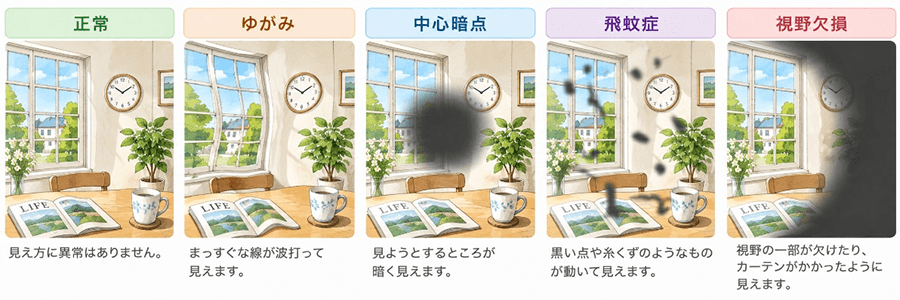 見え方の変化