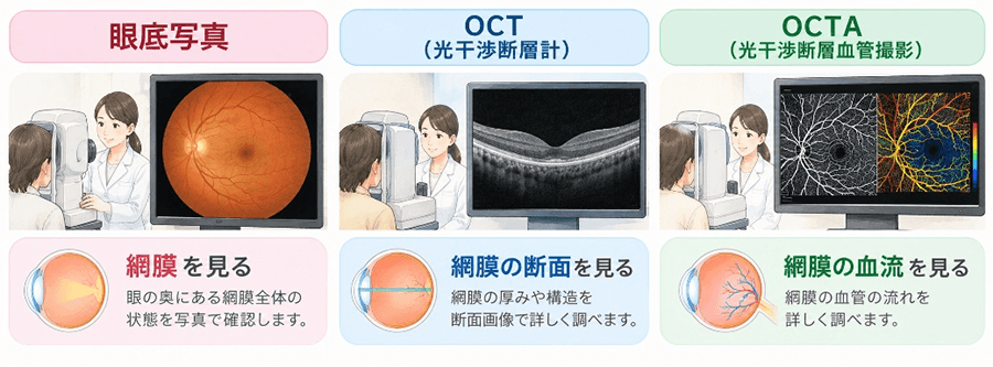 眼底検査。OCT（光干渉断層計）。OCTA（光干渉断層血管撮影）。