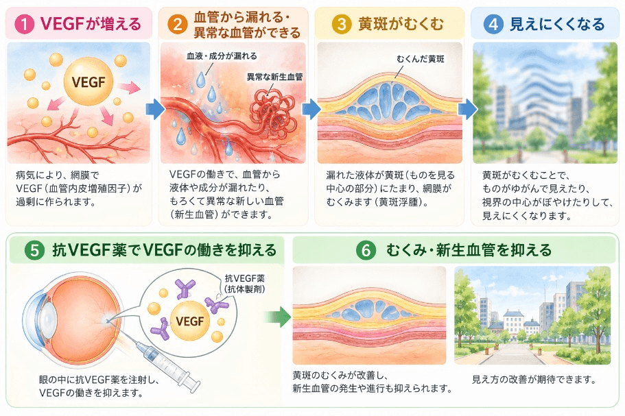 抗VEGF療法のしくみ