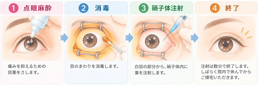 1.点眼麻酔→2.消毒→3.硝子体注射→4.終了