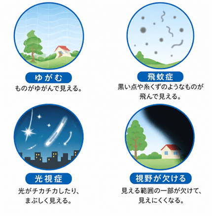 ゆがむ、飛蚊症、光視症、視野が欠ける。